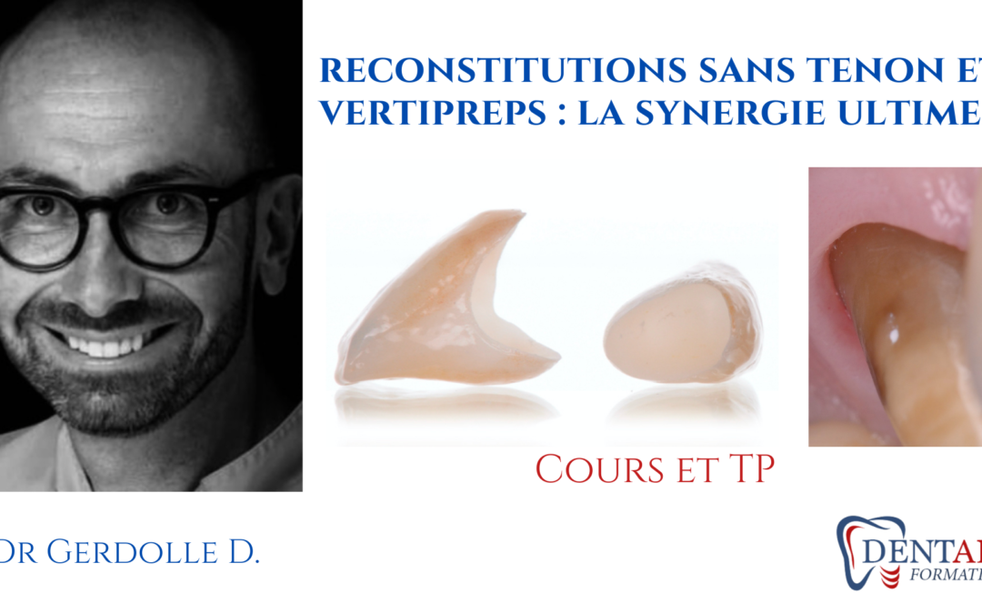 Reconstitution corono-radiculaire sans tenon et Verti-prep avec le Dr Gerdolle
