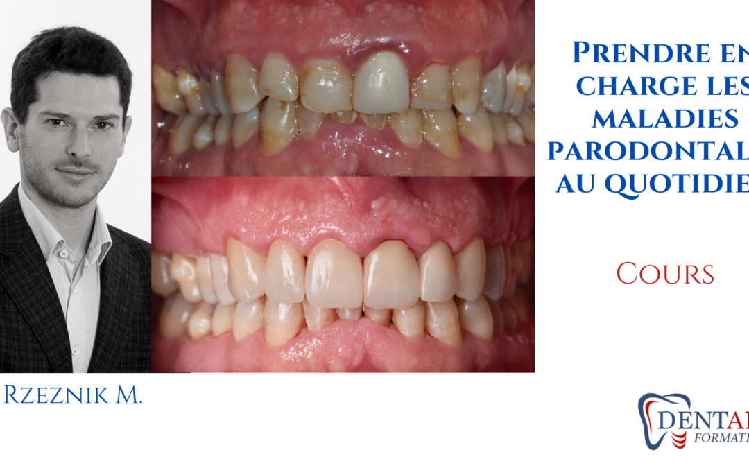 Parodontie clinique