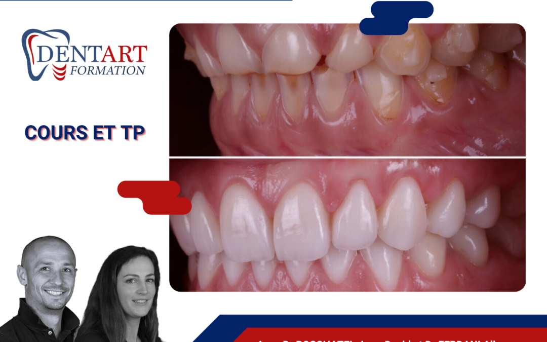 Usures et fonction 4.0